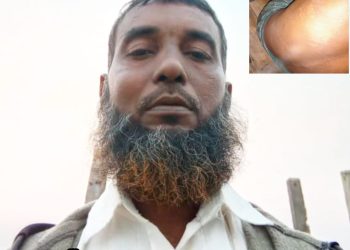 চাঁদা না দেওয়ায় জেলের উপর হামলা মৎসজীবিলীগ নেতার