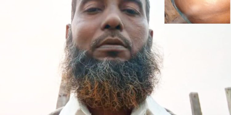 চাঁদা না দেওয়ায় জেলের উপর হামলা মৎসজীবিলীগ নেতার