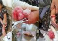 সাজেকে ইউপিডিএফ ও জেএসএস সংঘর্ষ গুলিবিদ্ধ ৮বছরের শিশু
